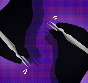Image of two hands with tweezers